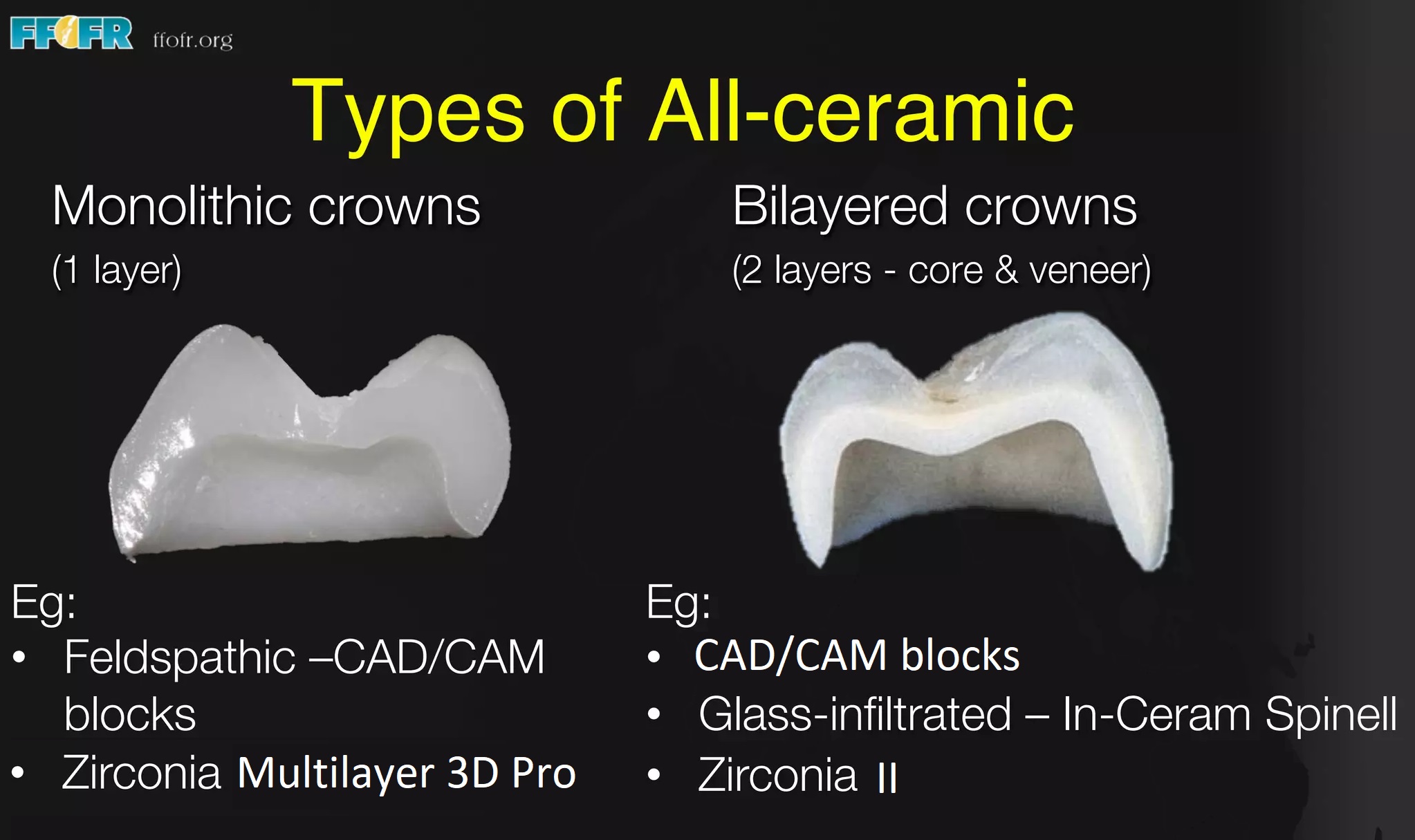 Răng sứ zirconia đa lớp vs răng toàn sứ lõi zirconia